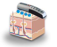 the comb laser stimulates on the biological hair system.